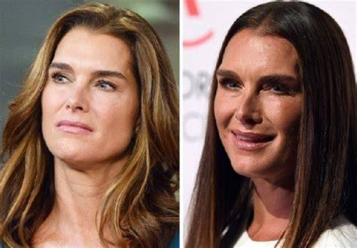 BROOKE SHIELDS Brooke Shields, Facelift, Being Ugly, Actors & Actresses