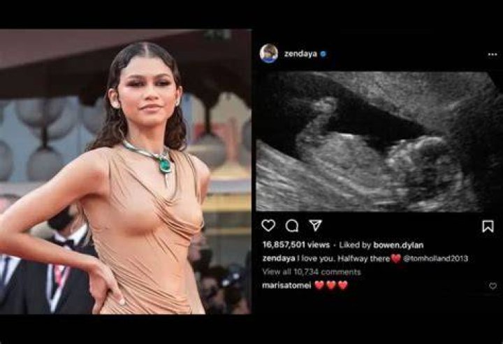 Is Zendaya Pregnant? Twitter Rumor Sparks Pandemonium